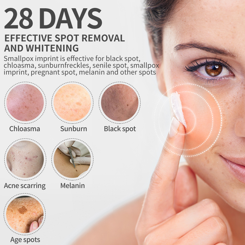Dimollaure Whitening Freckle C - Beauty Glazed Makeup recension och pris